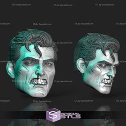 Custom Head STL Collection - Superman Damage