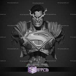 Superman Dark Night Bust Portrait Digital STL Files