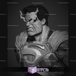 Superman Dark Night Bust Portrait Digital STL Files