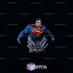 Superman Daily Planet Classic Bust 3D Printer Files