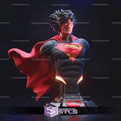 Absolute Superman Bust 3D Printer Files