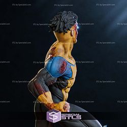 Invincible Injury Blood STL Files