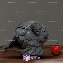 Bizarro Superman Injury Bust STL Files