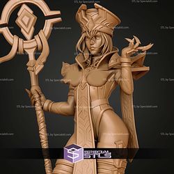 Sally Whitemane Stand Pose NSFW 190mm STL Files