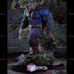 Bizarro Superman Injury STL Files