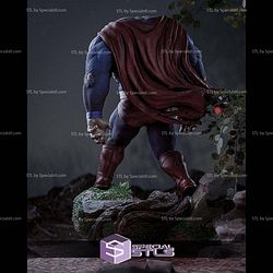 Bizarro Superman Injury STL Files